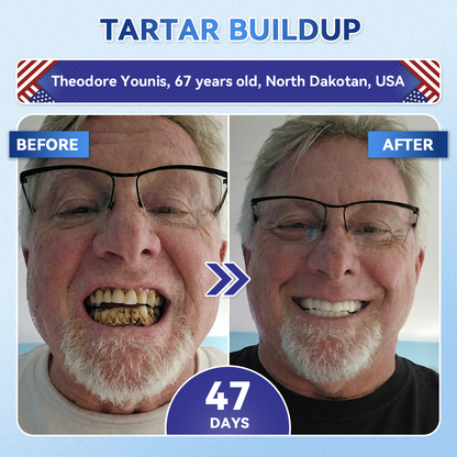 Glimmerly® 🦷 Tideglusib Fast‑Dissolving Tooth & Gum Repair Oral Strips 👀 (Supports tooth repair and helps relieve gum discomfort and other common oral concerns)