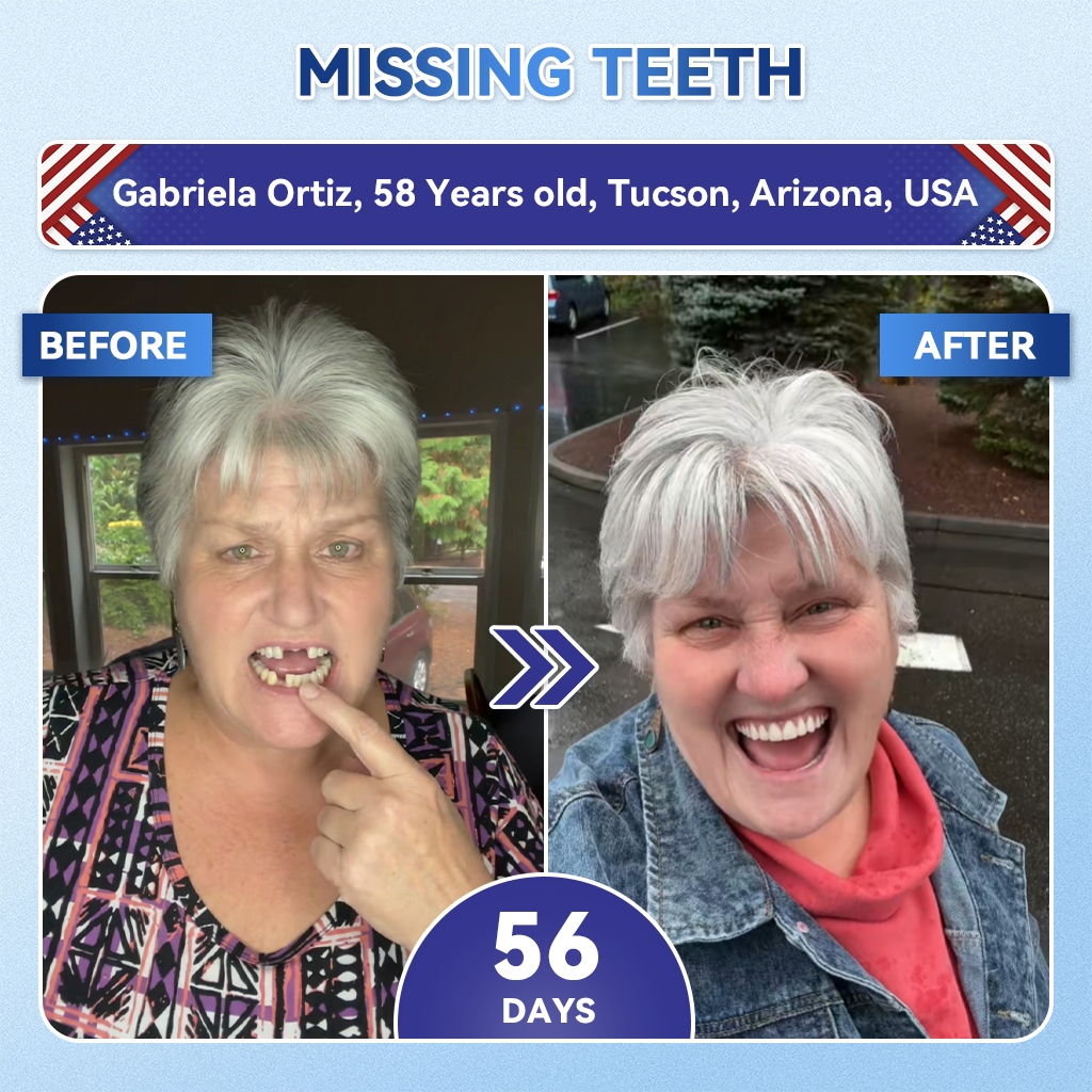 Glimmerly® 🦷 Tideglusib Fast‑Dissolving Tooth & Gum Repair Oral Strips 🌈 (Supports tooth repair and helps relieve gum discomfort and other common oral concerns)