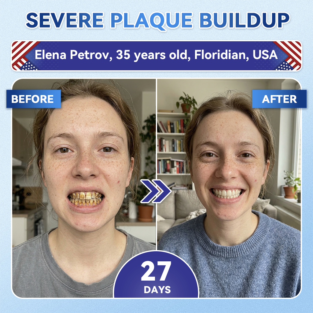 Glimmerly® 🦷 Tideglusib Fast‑Dissolving Tooth & Gum Repair Oral Strips 👀 (Supports tooth repair and helps relieve gum discomfort and other common oral concerns)