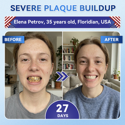 Glimmerly® 🦷 Tideglusib Fast‑Dissolving Tooth & Gum Repair Oral Strips 👀 (Supports tooth repair and helps relieve gum discomfort and other common oral concerns)