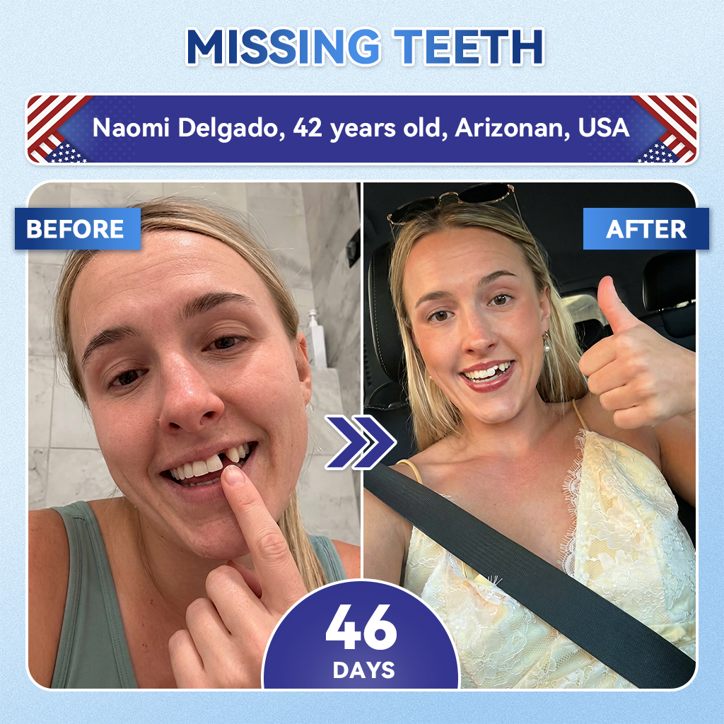 Glimmerly® 🦷 Tideglusib Fast‑Dissolving Tooth & Gum Repair Oral Strips 👀 (Supports tooth repair and helps relieve gum discomfort and other common oral concerns)