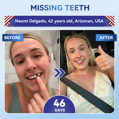 Glimmerly® 🦷 Tideglusib Fast‑Dissolving Tooth & Gum Repair Oral Strips 👀 (Supports tooth repair and helps relieve gum discomfort and other common oral concerns)