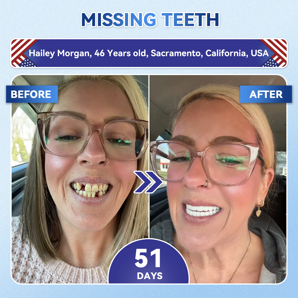 Glimmerly® 🦷 Tideglusib Fast‑Dissolving Tooth & Gum Repair Oral Strips 🌈 (Supports tooth repair and helps relieve gum discomfort and other common oral concerns)
