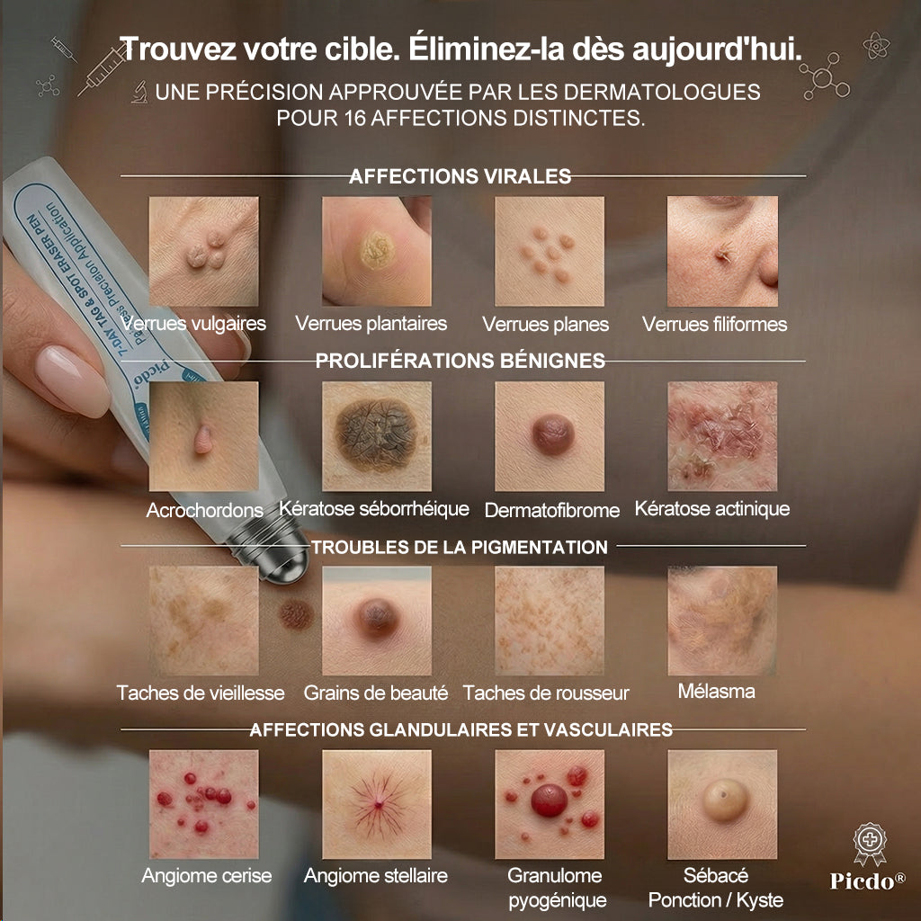 𝐏i𝐜𝐝o® 7 𝑱𝒐𝒖𝒓𝒔 𝑬𝒇𝒇𝒂𝒄𝒆𝒖𝒓 𝒅𝒆 𝒕𝒂𝒄𝒉𝒆𝒔 𝒆𝒕 𝒅’𝒆𝒙𝒄𝒓𝒐𝒊𝒔𝒔𝒂𝒏𝒄𝒆𝒔 𝒄𝒖𝒕𝒂𝒏é𝒆𝒔(Roll-on zéro douleur, zéro cicatrice)