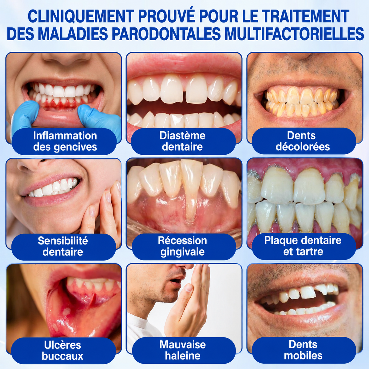 🇨🇦 𝑮𝒍𝒊𝒎𝒎𝒆𝒓𝒍𝒚®🦷 𝑮𝒖𝒎𝑹𝒆𝒗𝒊𝒗𝒆 𝑮𝒆𝒍 𝒅𝒆 𝑹é𝒑𝒂𝒓𝒂𝒕𝒊𝒐𝒏 𝑷𝒂𝒓𝒐𝒅𝒐𝒏𝒕𝒂𝒍𝒆🌻