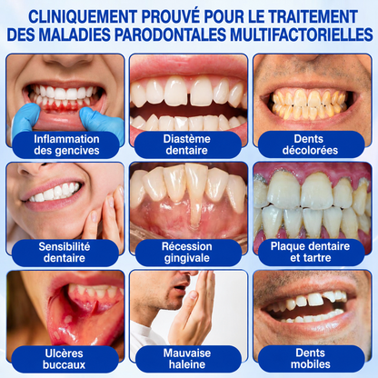 🇨🇦 𝑮𝒍𝒊𝒎𝒎𝒆𝒓𝒍𝒚®🦷 𝑮𝒖𝒎𝑹𝒆𝒗𝒊𝒗𝒆 𝑮𝒆𝒍 𝒅𝒆 𝑹é𝒑𝒂𝒓𝒂𝒕𝒊𝒐𝒏 𝑷𝒂𝒓𝒐𝒅𝒐𝒏𝒕𝒂𝒍𝒆🌻