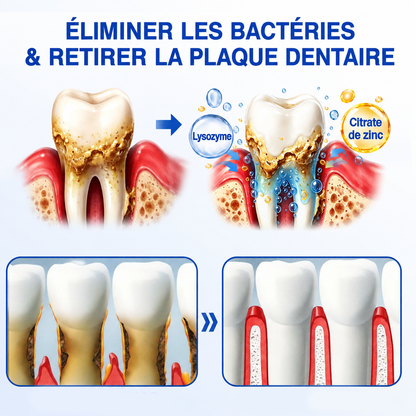 🇨🇦 𝑮𝒍𝒊𝒎𝒎𝒆𝒓𝒍𝒚®🦷 𝑮𝒖𝒎𝑹𝒆𝒗𝒊𝒗𝒆 𝑮𝒆𝒍 𝒅𝒆 𝑹é𝒑𝒂𝒓𝒂𝒕𝒊𝒐𝒏 𝑷𝒂𝒓𝒐𝒅𝒐𝒏𝒕𝒂𝒍𝒆🌻