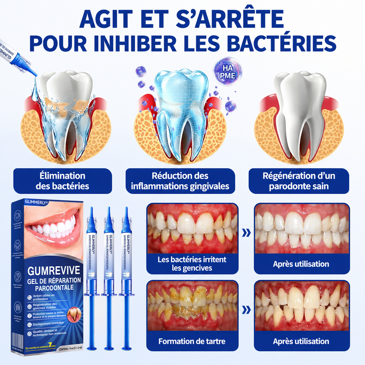 🇨🇦 𝑮𝒍𝒊𝒎𝒎𝒆𝒓𝒍𝒚®🦷 𝑮𝒖𝒎𝑹𝒆𝒗𝒊𝒗𝒆 𝑮𝒆𝒍 𝒅𝒆 𝑹é𝒑𝒂𝒓𝒂𝒕𝒊𝒐𝒏 𝑷𝒂𝒓𝒐𝒅𝒐𝒏𝒕𝒂𝒍𝒆🌻